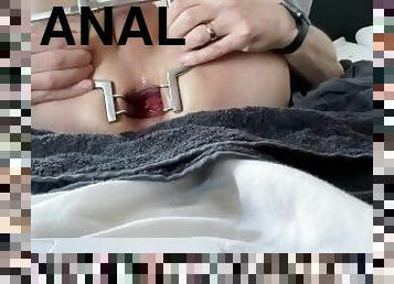 Anal spreader opens me wide