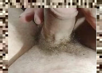 Ingrown hairs! Shouldn't have shaved!