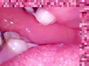 Inside my mouth with braces